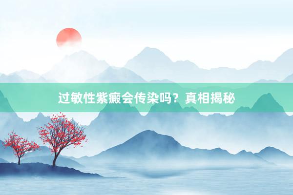 过敏性紫癜会传染吗？真相揭秘